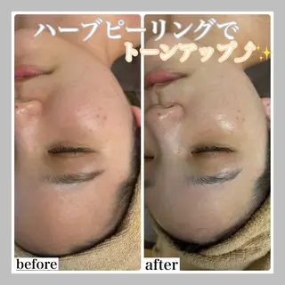 WHITE AQUA 北千住店のエステ・リラクイメージ