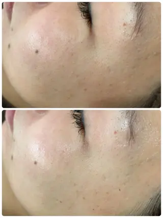 espoir エスポワールのネイルデザイン