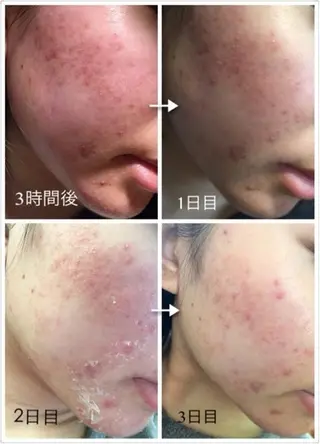 FLEUR大阪・美容 整体・痩身・小顔のエステ・リラクイメージ