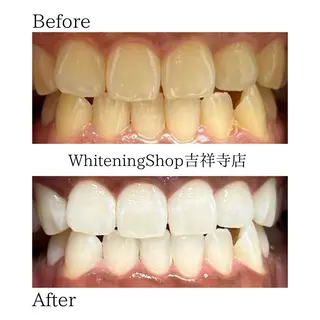 ホワイトニング ショップ吉祥寺店のエステ・リラクイメージ