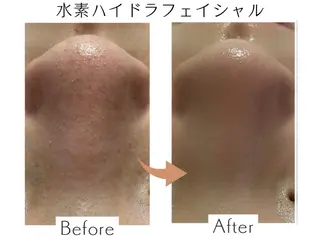 プライベートサロン Belle(ベル)のエステ・リラクイメージ