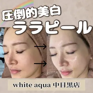 中目黒ハーブピーリン グ🌿ララピールのエステ・リラクイメージ