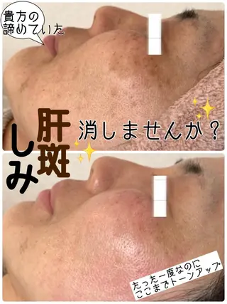 堀井 舞琳のエステ・リラクイメージ