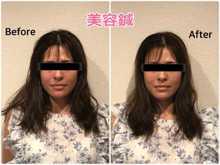 チキバン美容鍼灸整体 サロン心斎橋店のエステ・リラクイメージ