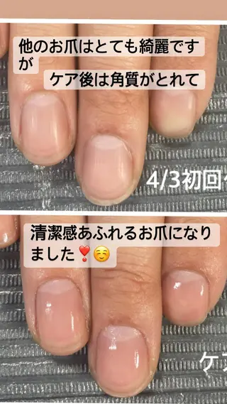 ネイル 奥園 良恵のネイルデザイン