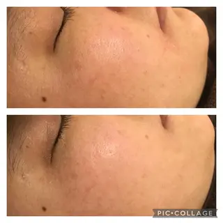 ショート カラー パーマ ヘアアレンジ メンズ キッズ ネイル マツエク・マツパ アイブロウ アニメ,Vオタク× 即効痩せエステサロンのエステ・リラクイメージ