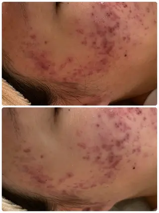 メンズ キッズ 肌質改善・脱毛サロン Luangeのエステ・リラクイメージ