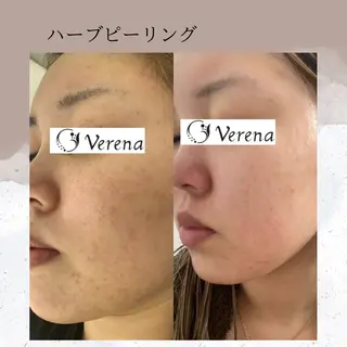 ピーリング専門店 Belluteのエステ・リラクイメージ