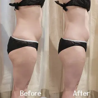 MyFairLady miuのエステ・リラクイメージ