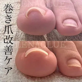 ネイル 毛穴改善/脱毛 ネイル 川上久仁子のエステ・リラクイメージ