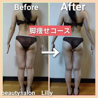 beautysalon Lily所属・Yamaguchi Erikaのエステ・リラクイメージ