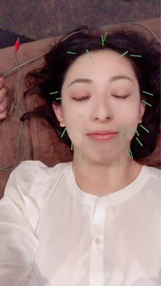 美容鍼灸サロン LOMIHARIのエステ・リラクイメージ