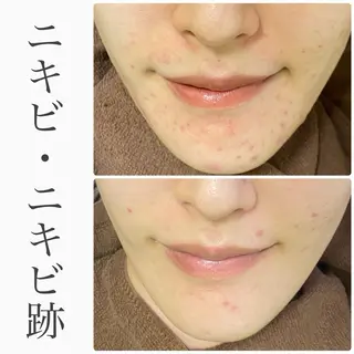 ハーブピーリング専門 BIOEL横浜のエステ・リラクイメージ