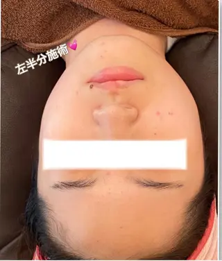 FLEUR大阪・整体 ・ハイフ・痩身・小顔のエステ・リラクイメージ