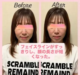 kuchimoto beauty couture  Ai所属・couture Aiのエステ・リラクイメージ