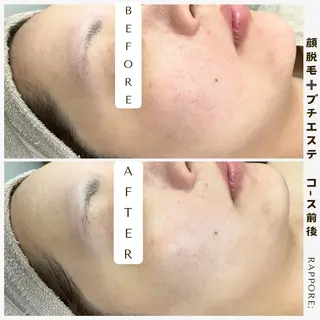 Rappore; 心斎橋　みずきのエステ・リラクイメージ