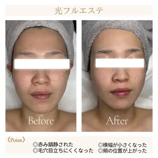 Grande所属・11/1〜Open！ 旭川ナリス脱毛エステのエステ・リラクイメージ