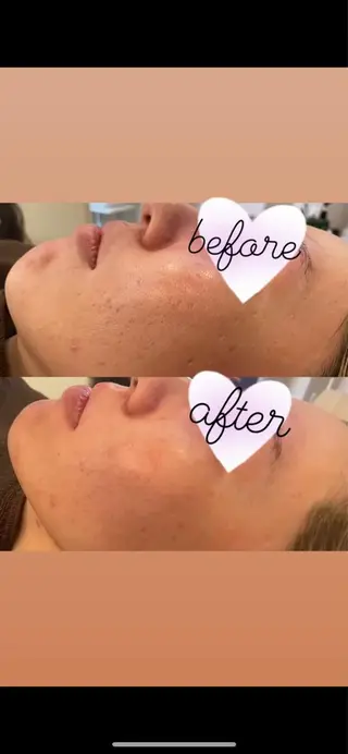 VERY VERY九条店所属・ベリーベリー🌹 九条店のエステ・リラクイメージ