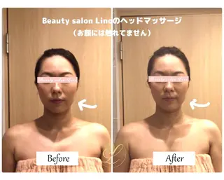 痩身×フェイシャル ブライダル|Linoのエステ・リラクイメージ