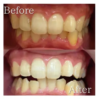 LBSホワイトニング 🌐岡山店のその他イメージ