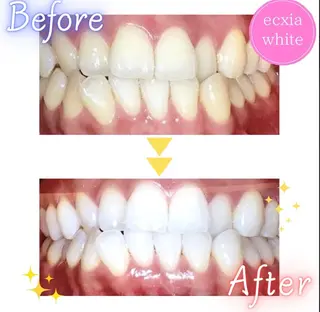 エクシアホワイト 立川南口のエステ・リラクイメージ