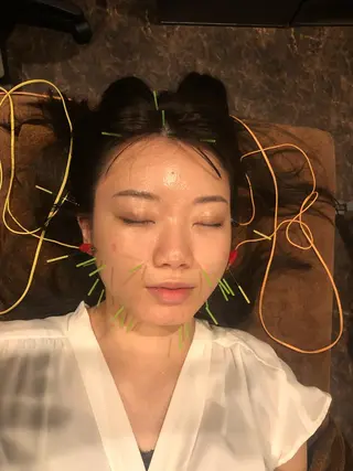 メンズ 美容鍼灸サロン LOMIHARIのエステ・リラクイメージ