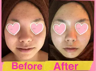 痩身リンパダイエット 隠れ家サロンチャームのエステ・リラクイメージ