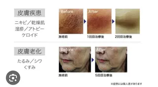 セレブリボーンパッシブタウン　プレミア所属・目澤 幸代のエステ・リラクイメージ