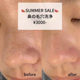 salonLADYSTYLE所属・稲嶺 美華のエステ・リラクイメージ