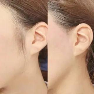 アイブロウサロン&α神戸三宮店所属・アイブロウサロン&α 神戸三宮店の眉毛・アイブロウイメージ