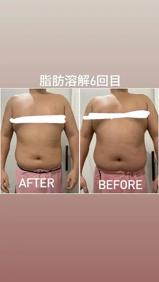 毛穴洗浄・痩身・脱毛 /アルカンジュのエステ・リラクイメージ