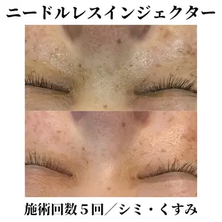 トータルビューティー サロンSalaのマツエク・マツパデザイン