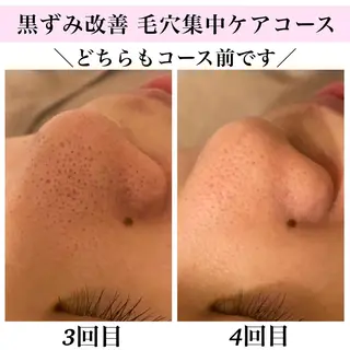 Bellesthe (ベルエステ)のエステ・リラクイメージ