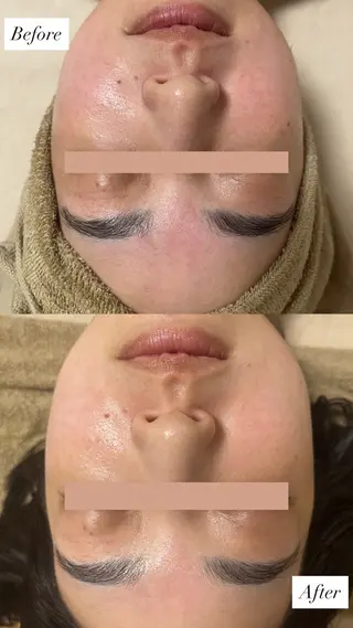 salon More所属・出口 玲菜のエステ・リラクイメージ