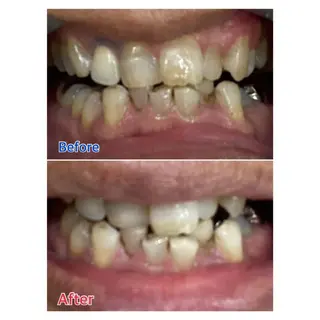 MBEAUTYSALON 千葉店・京成大久保所属・Melty 輝のその他イメージ