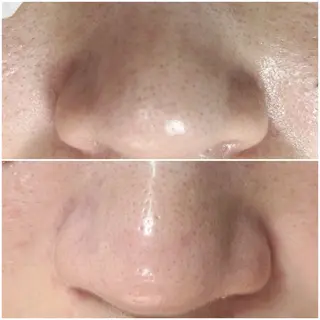 毛穴洗浄専門店/ 泉佐野/oluoluのエステ・リラクイメージ