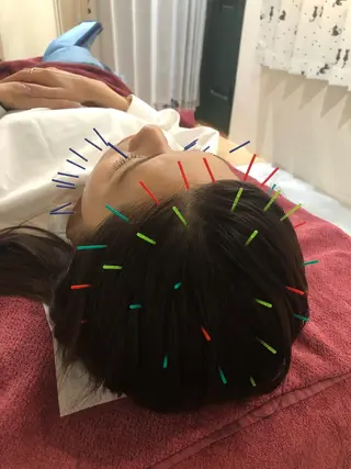 美容鍼灸女性専用 りんご鍼灸治療院のその他イメージ