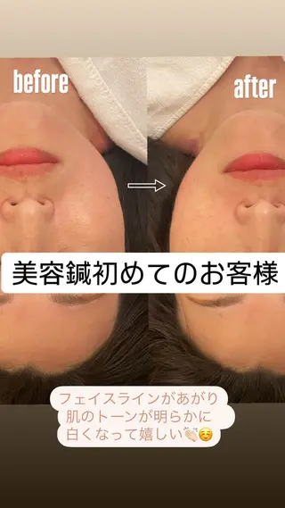 美容鍼/鍼灸 ここみ鍼灸院のエステ・リラクイメージ