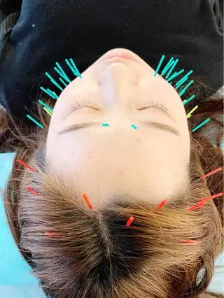 小顔美容鍼専門サロン 渋谷YZのエステ・リラクイメージ