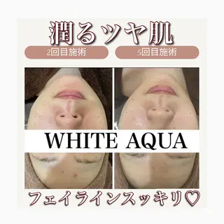 White Aqua 福岡博多店のエステ・リラクイメージ