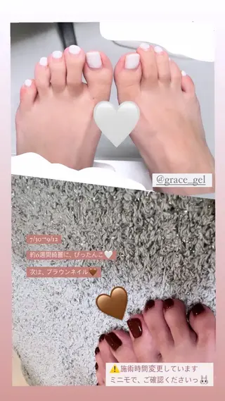 メンズ ネイル 爪ケア/深爪 自爪育成 🐰えむのネイルデザイン