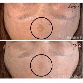 最新シミケアLily de pearlのエステ・リラクイメージ