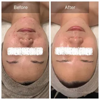 Charis エステ&ネイルのエステ・リラクイメージ