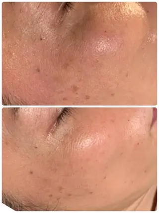 esty hitomiのエステ・リラクイメージ