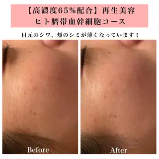 Bellesthe (ベルエステ)のエステ・リラクイメージ