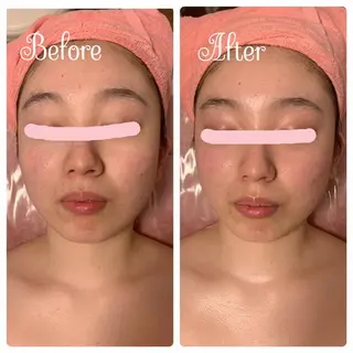 透明感の肌Lino malieのエステ・リラクイメージ