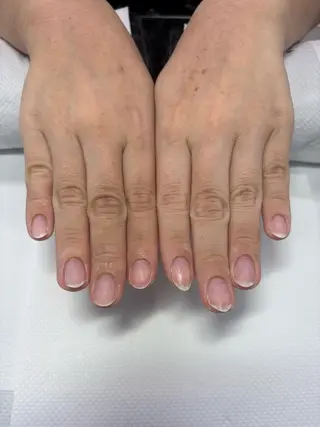ネイル 楠本 琴音のネイルデザイン