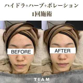 美肌サロンTIAM by tetoteのエステ・リラクイメージ