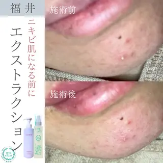 毛穴ケア専門サロン Yourmeユアミーのエステ・リラクイメージ