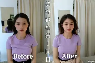 鍼灸整骨院Refine所属・鍼灸 Refineのその他イメージ